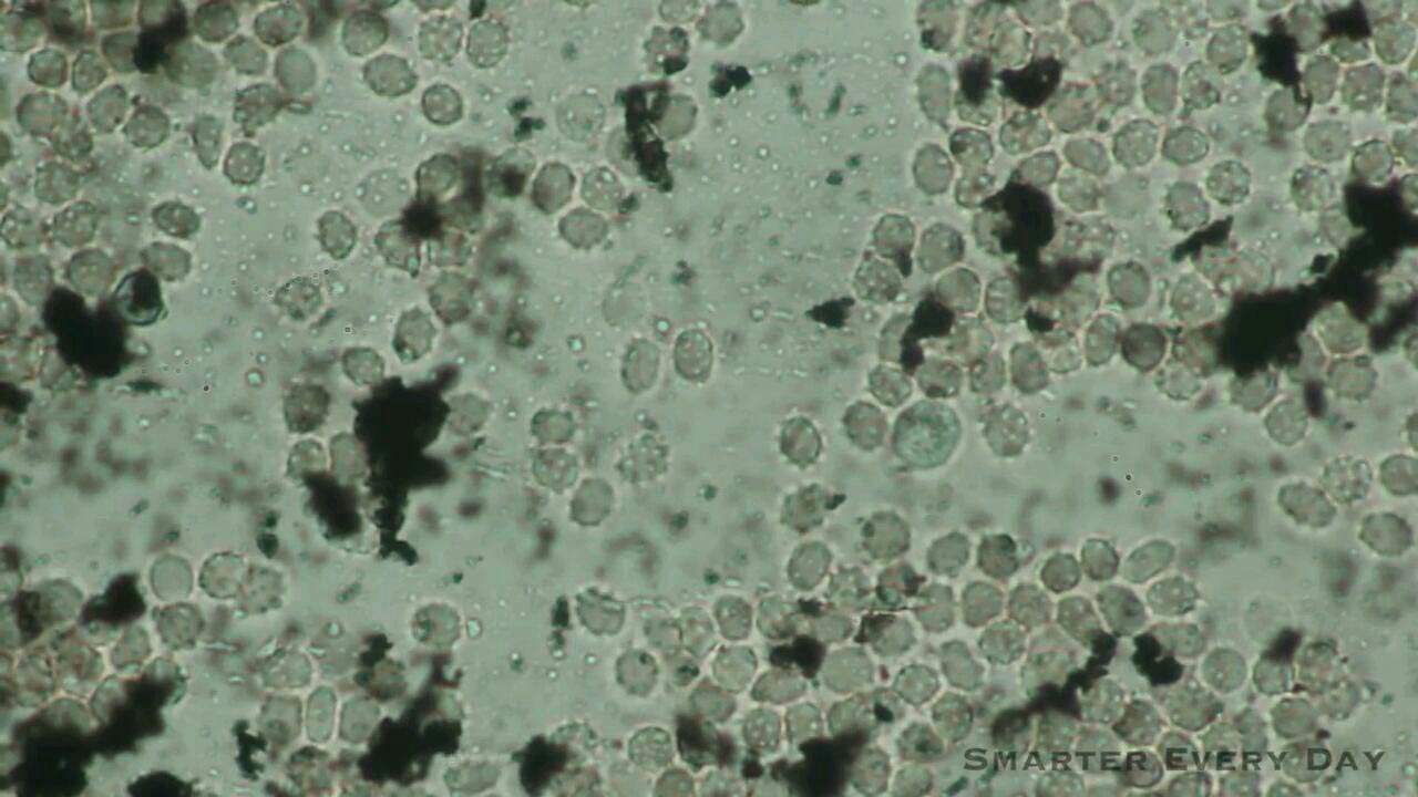 پیگمانته و گلبولهای سفید زیر میکروسکوپ